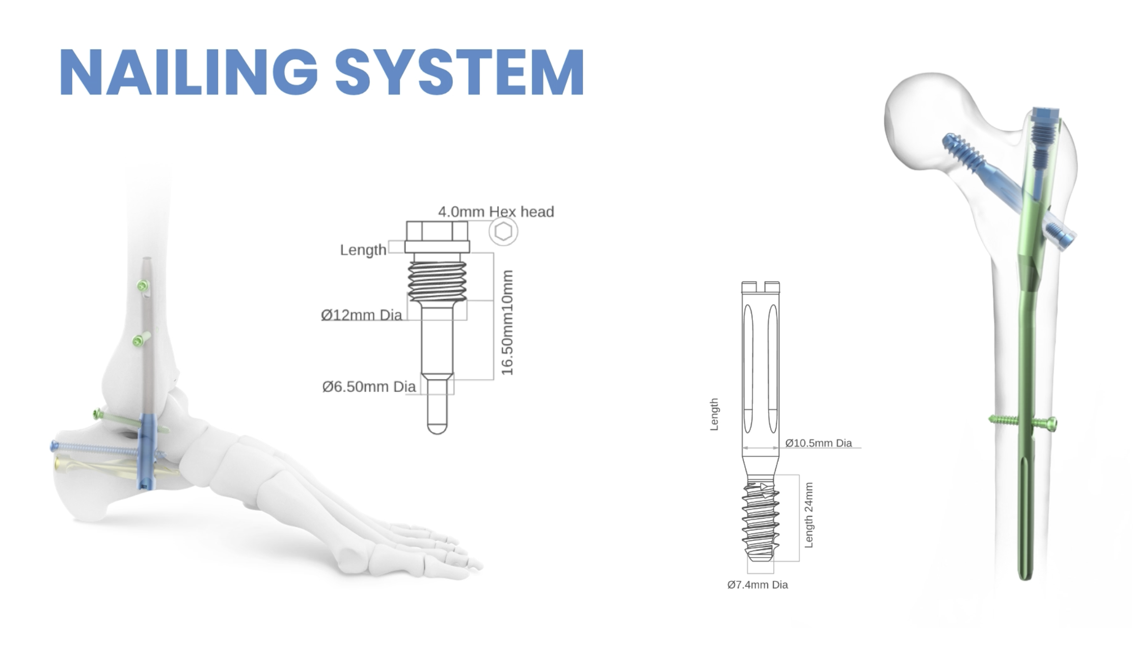 Nailing System