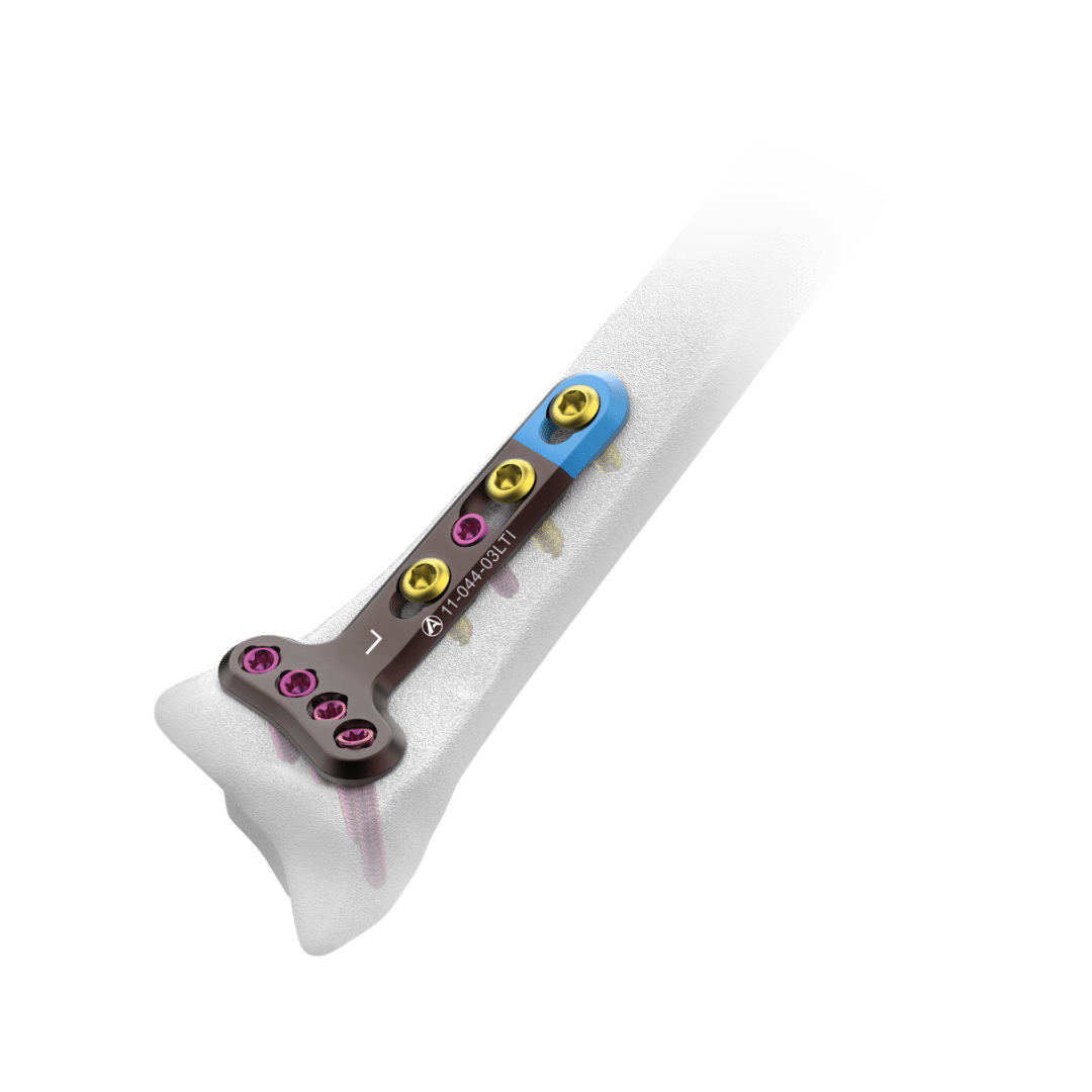 Hand, Wrist, Foot & Ankle Plating System